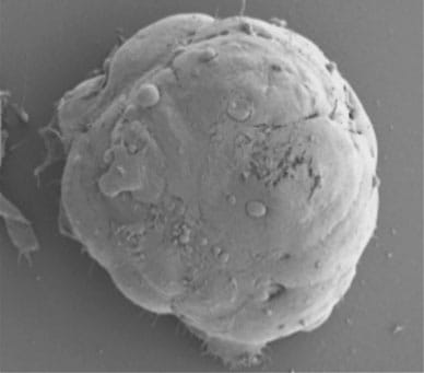 Electron microscopy image of stem cell with gene knockout